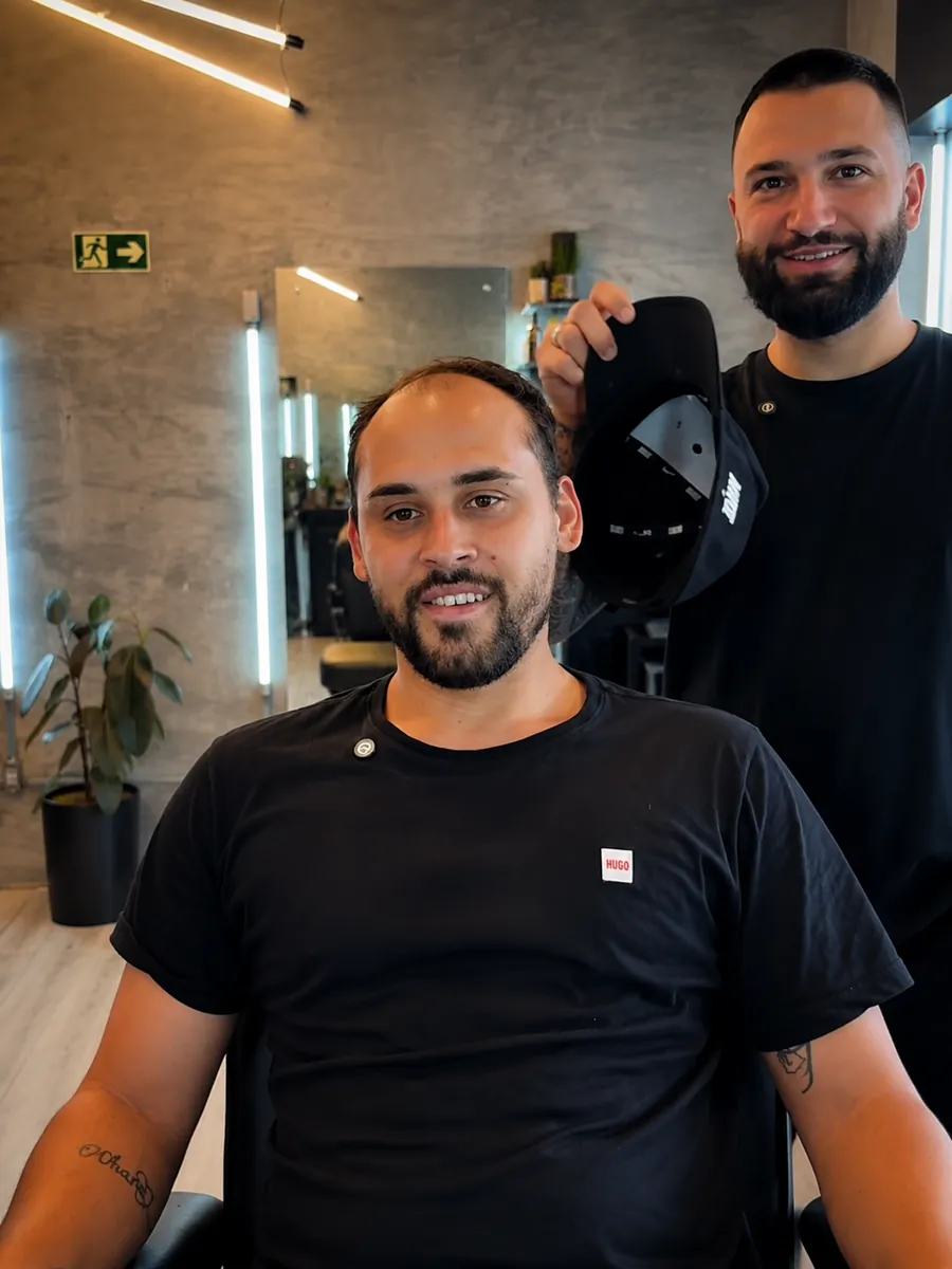 Cliente antes da colocação da prótese capilar